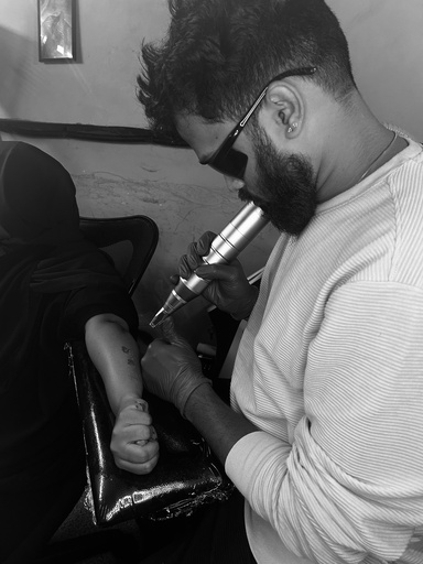 Laser Tattoo Removal